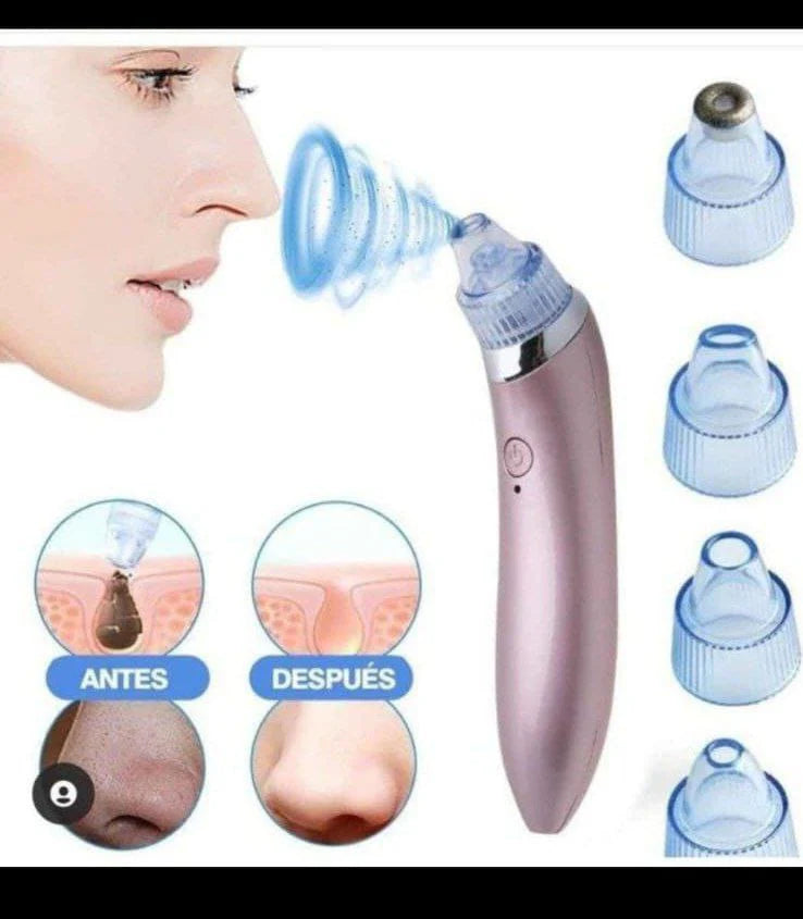 Removedor de Puntos Negros Eléctrico | Limpieza Facial Profunda